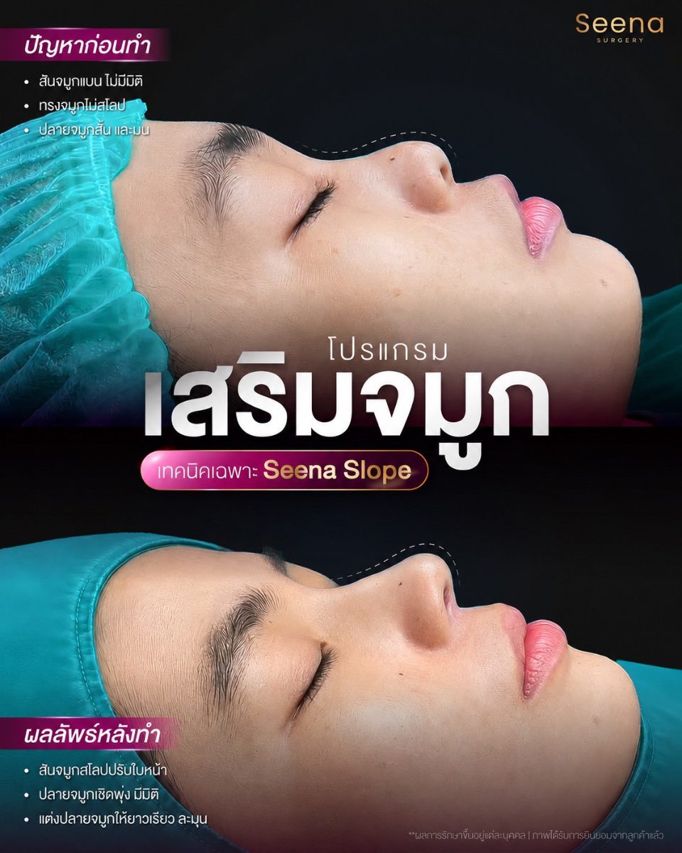 คุณ nankam hom